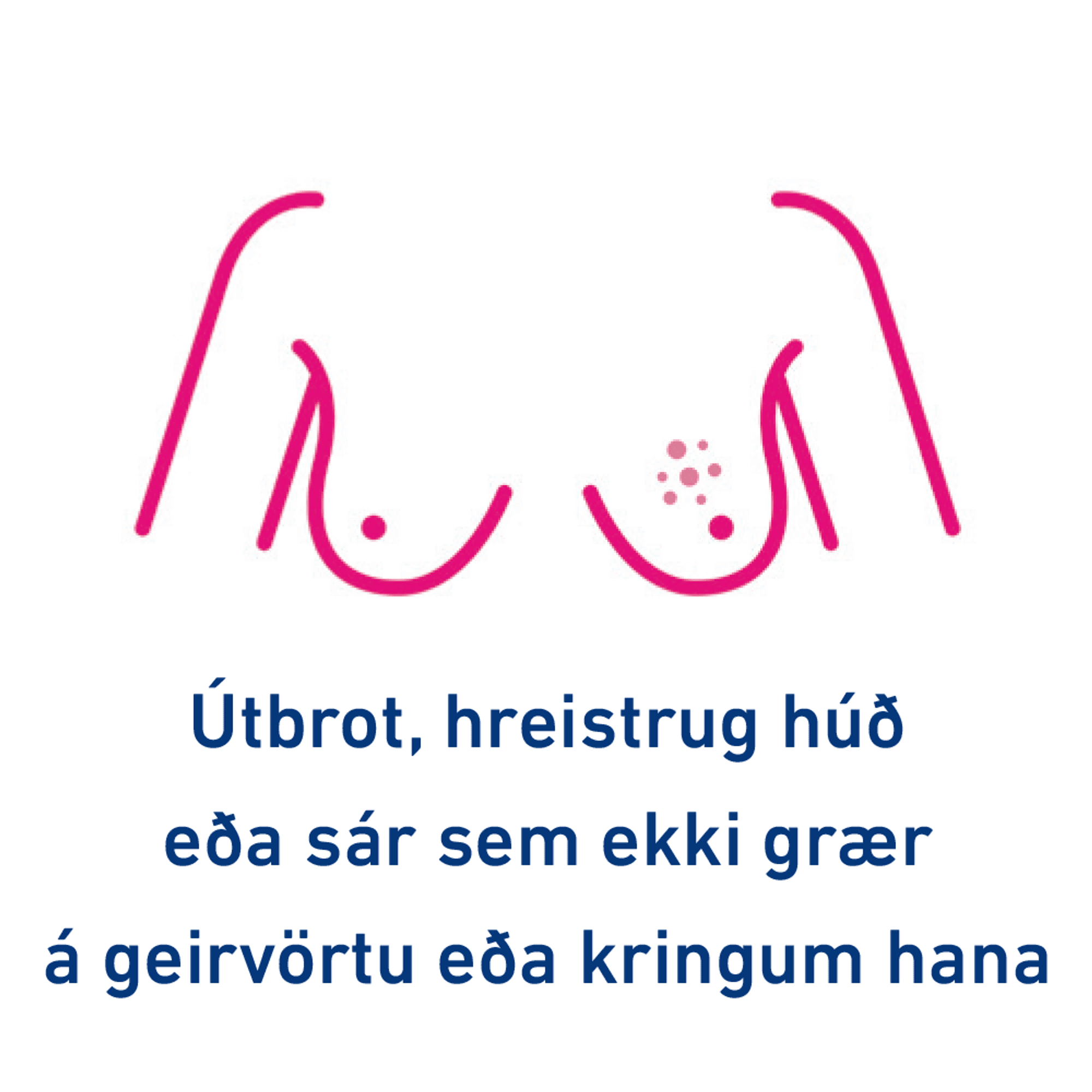 Útbrot, hreistrug húð eða sár sem ekki grær á geirvörtu eða kringum hana